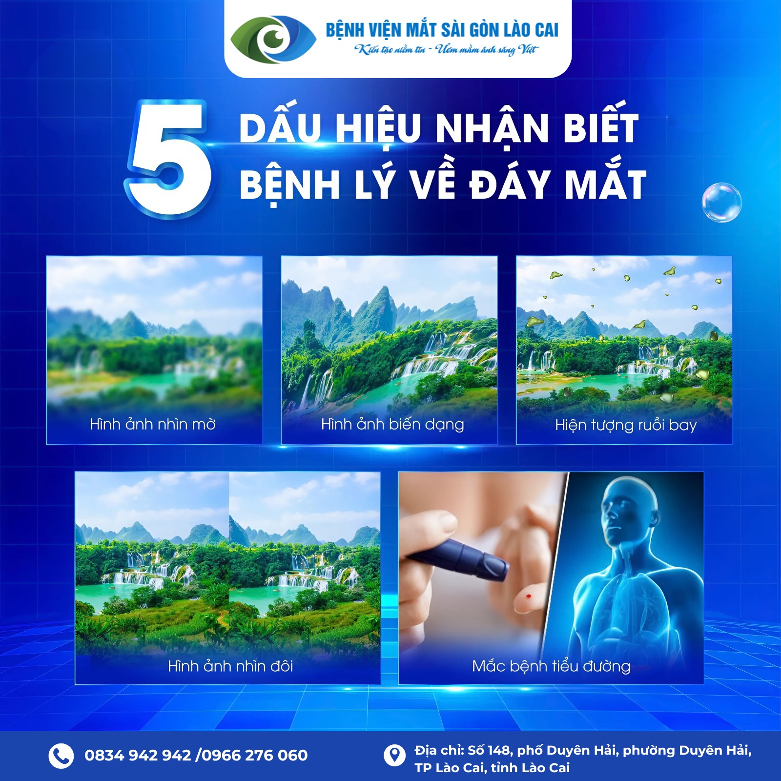 CẢNH BÁO: DẤU HIỆU BỆNH LÝ ĐÁY MẮT_ĐỪNG CHỦ QUAN!